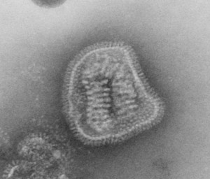 Foto "virus" gripal (influenza)